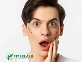 cara menghilangkan jerawat batu di pipi dengan cepat - Cara Menghilangkan Jerawat Batu di Pipi dengan Cepat
